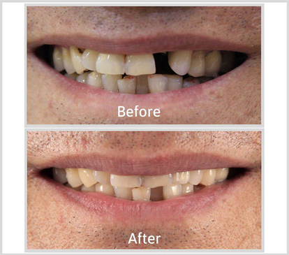 Slider image (4) Home Dental Clinic